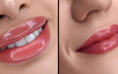 The Best Care After a Semi-Permanent Lip Blush Procedure